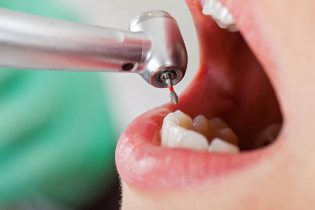 Best Urgent Tooth Repair  in Polkton, NC